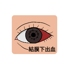 [LINEスタンプ] 眼科疾患1